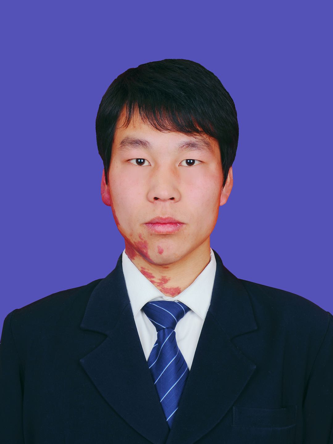 周勇